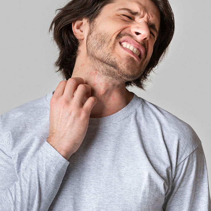 Natural treatment for eczema with Ayurvedic therapy