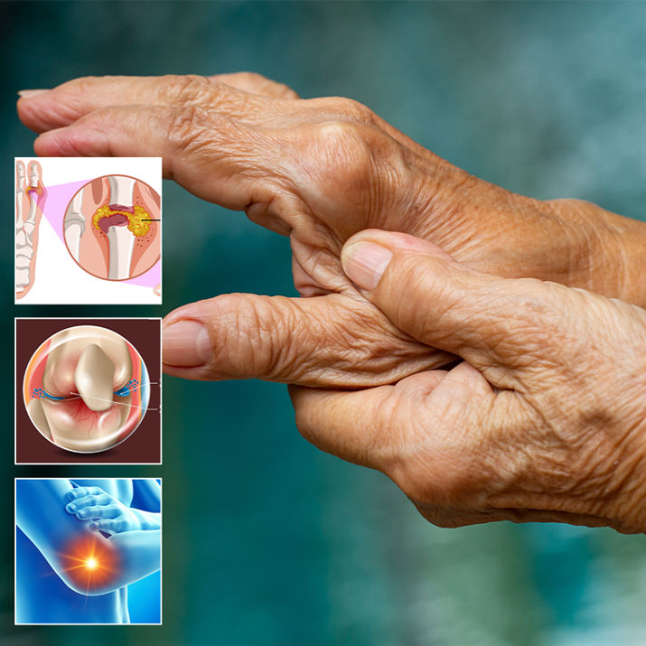 Ayurvedic treatment for arthritis with natural therapies for joint pain relief